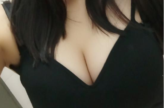 武漢伽美醫(yī)療美容醫(yī)院醫(yī)生朱富初做自體脂肪隆胸怎么樣？看案例