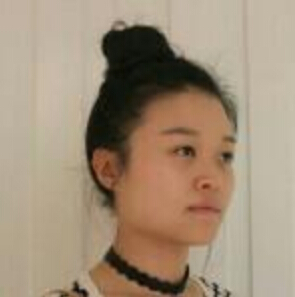 上海時光整形醫(yī)院左雯君醫(yī)生注射瘦臉針效果怎么樣？附真實(shí)案例圖