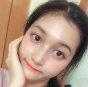 上海時光整形醫(yī)院做面部玻尿酸注射效果怎么樣？