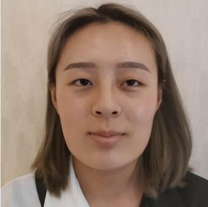上海時(shí)光整形醫(yī)院做雙眼皮怎么樣？附石重明醫(yī)生雙眼皮+隆鼻+下頜角磨骨案例效果對(duì)比圖