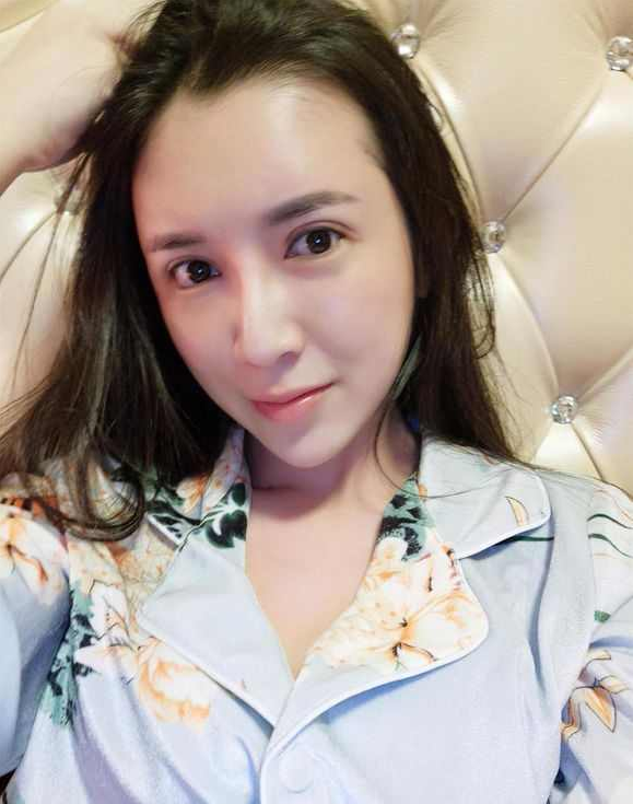上海時(shí)光整形醫(yī)院張晶醫(yī)生做開(kāi)眼角怎么樣？附真實(shí)效果圖