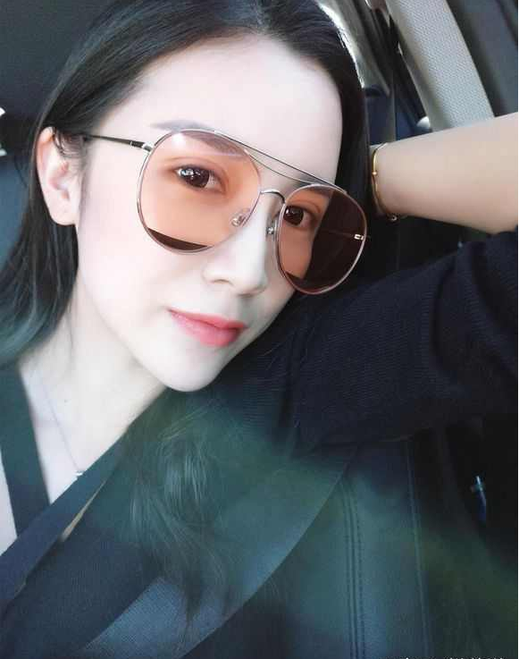 上海時(shí)光整形醫(yī)院張晶醫(yī)生做開(kāi)眼角怎么樣？附真實(shí)效果圖