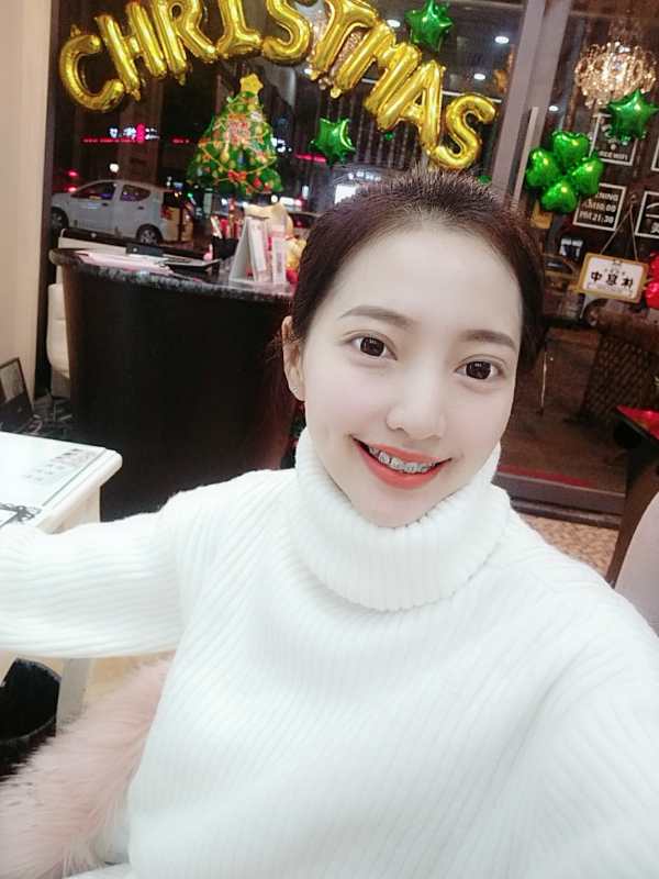 巴中華醫(yī)口腔醫(yī)院做牙齒矯正效果好嗎？附母汶靈醫(yī)生牙齒矯正案例效果圖