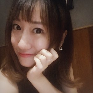 蚌埠韓美美萊整形做玻尿酸面部除皺效果怎么樣？附陳澤醫(yī)生案例效果圖