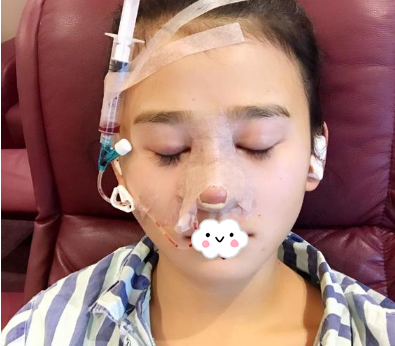 蚌埠韓美美萊整形醫(yī)生歷芳做耳軟骨隆鼻怎么樣？附耳軟骨隆鼻案例對比圖