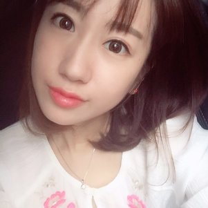 蚌埠韓美美萊整形做玻尿酸面部除皺效果怎么樣？附陳澤醫(yī)生案例效果圖