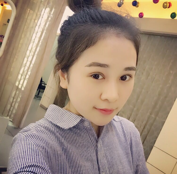 蚌埠韓美美萊整形醫(yī)生鄭捷做開眼角怎么樣？附案例效果圖