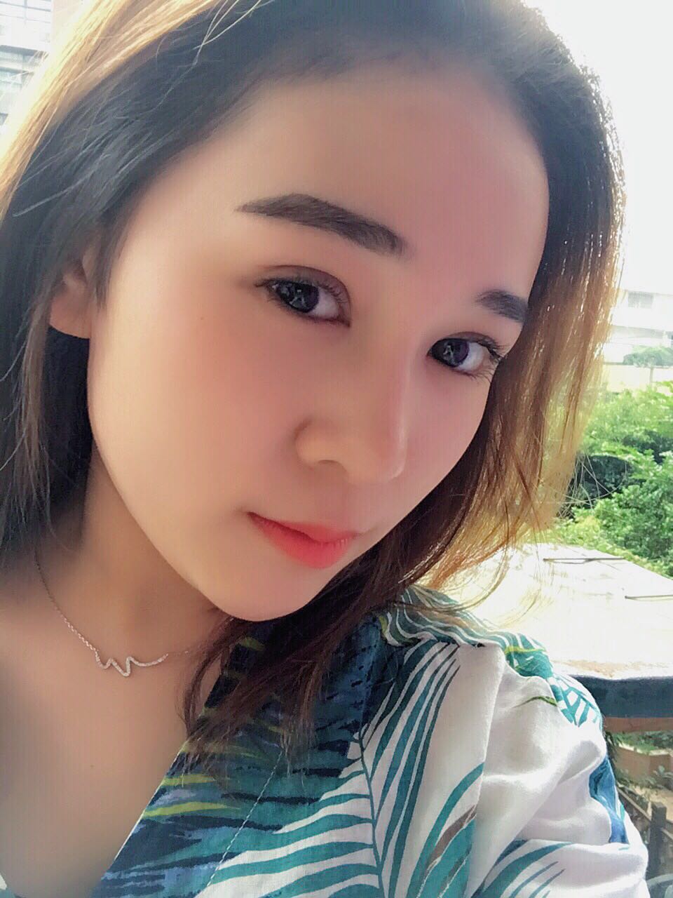 蚌埠韓美美萊整形醫(yī)生鄭捷做開眼角怎么樣？附案例效果圖