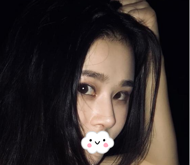 蚌埠韓美美萊整形醫(yī)生歷芳做耳軟骨隆鼻怎么樣？附耳軟骨隆鼻案例對(duì)比圖