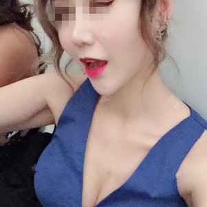 保定杏林中醫(yī)醫(yī)院整形外科醫(yī)生從相文做自體脂肪隆胸效果怎么樣？附隆胸案例