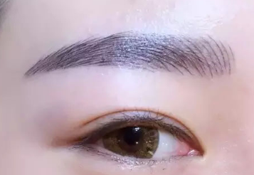 除皺去眼袋需要多少錢？價格貴嗎？