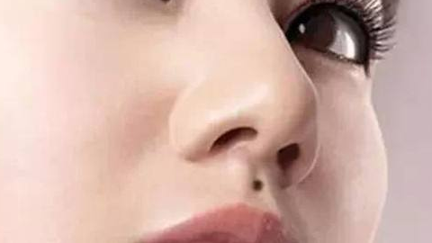 綜合隆鼻價格需要多少錢？價格貴嗎？