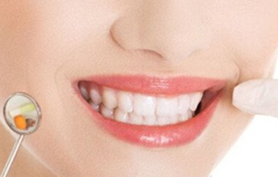 美容冠矯正是什么意思？
