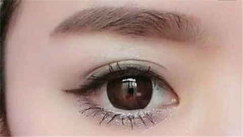 埋線雙眼皮疼嗎？雙眼皮手術(shù)多少錢一次？