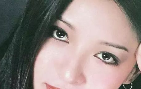 割雙眼皮會(huì)反彈嗎？