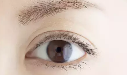做雙眼皮的效果如何？