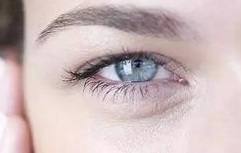 開內(nèi)眼角的弊端有哪些？
