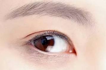 開內(nèi)眼角大概多少錢？