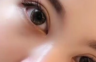 開眼角有沒有風(fēng)險？