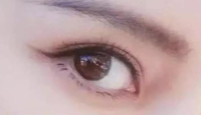開眼角術大概要多少錢？