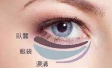 激光能祛除眼袋嗎？