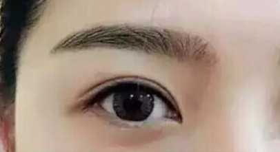 西安割雙眼皮效果好的醫(yī)院有哪幾家？人氣前六盤點！