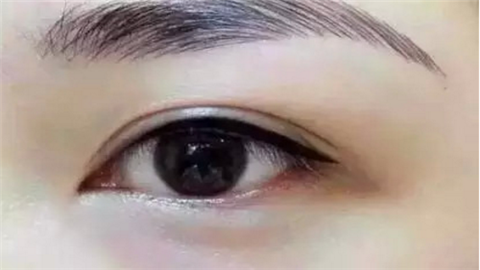 昆山雙眼皮整形醫(yī)院哪幾家好？實(shí)力口碑醫(yī)院推薦！