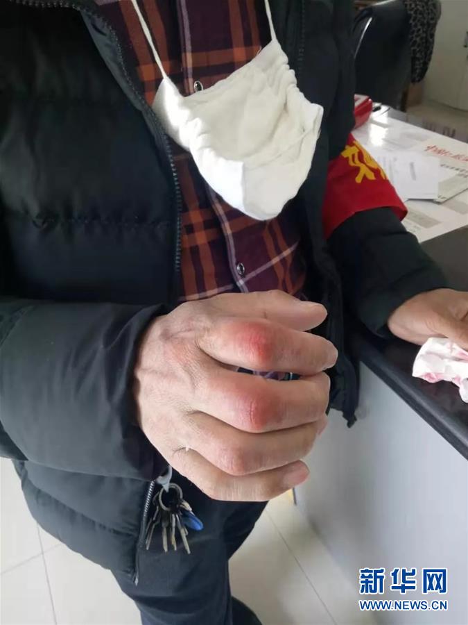 (在習(xí)近平新時(shí)代中國(guó)特色社會(huì)主義思想指引下——新時(shí)代新作為新篇章·習(xí)近平總書(shū)記關(guān)切事·圖文互動(dòng))(2)戰(zhàn)“疫”中的“凡人微光”