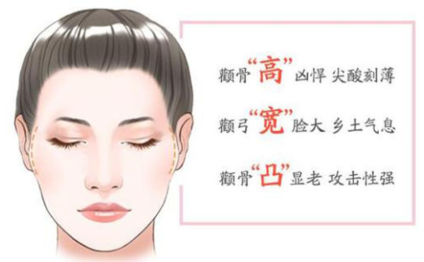 顴骨內(nèi)推整形適宜人群？