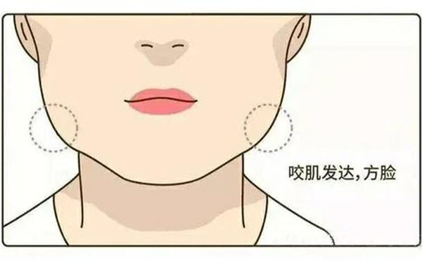 為什么咬肌會肥大？