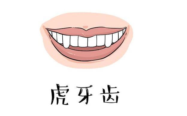 虎牙矯正一般多少錢(qián)？