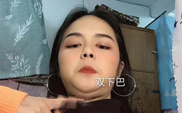 吸脂去雙下巴和溶脂瘦下巴有什么區(qū)別？