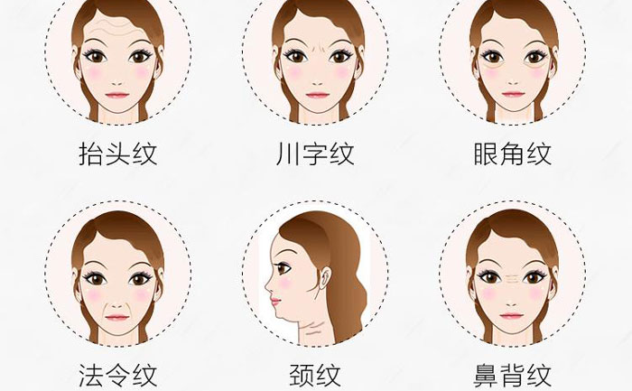 botox除皺針有哪些副作用？