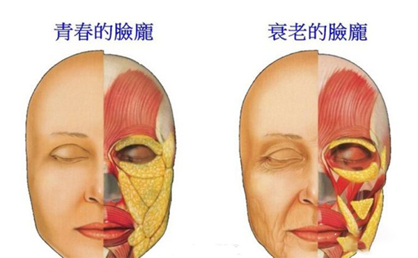 電波拉皮的誤區(qū)？