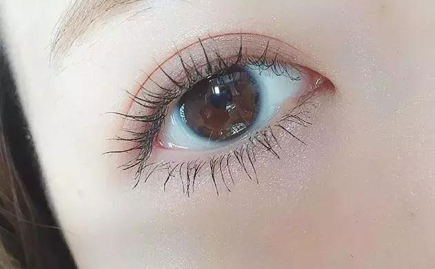 激光雙眼皮手術(shù)多少錢？激光雙眼皮手術(shù)需要多久恢復(fù)時(shí)間？