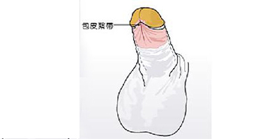 切包皮術后