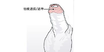 切包皮術前