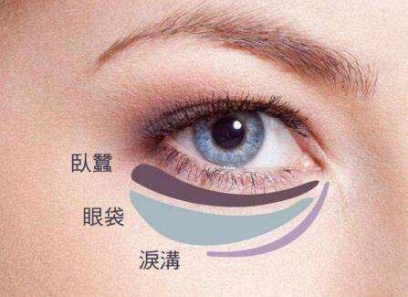 眼袋失敗修復要怎么處理？切眼袋需要多長時間恢復？