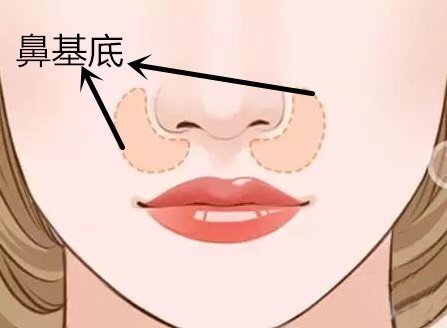 做玻尿酸墊鼻基底風(fēng)險(xiǎn)有哪些？深圳市玻尿酸豐鼻基底大概需要費(fèi)用？