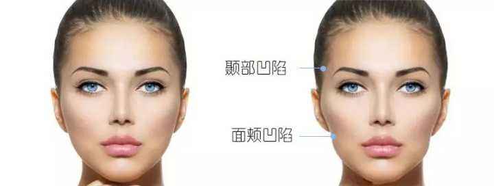 熱瑪吉做一次可以保持多久？熱瑪吉的原理和功效