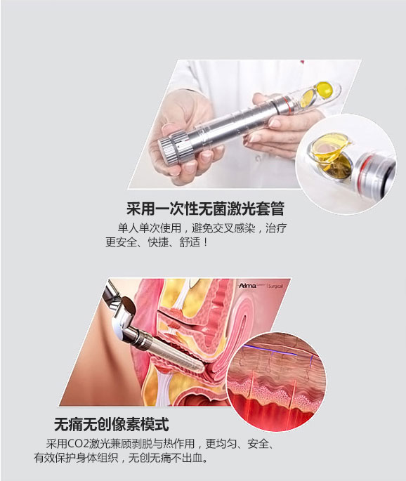 成都愛爾麗整形激光緊縮陰道怎么樣？激光緊縮陰道注意什么？