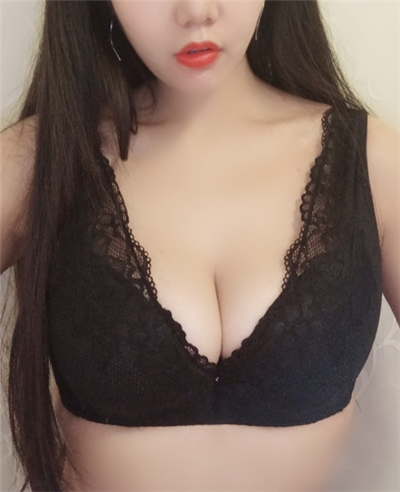慈溪悅爾醫(yī)學美容醫(yī)院做隆胸手術后的第58天