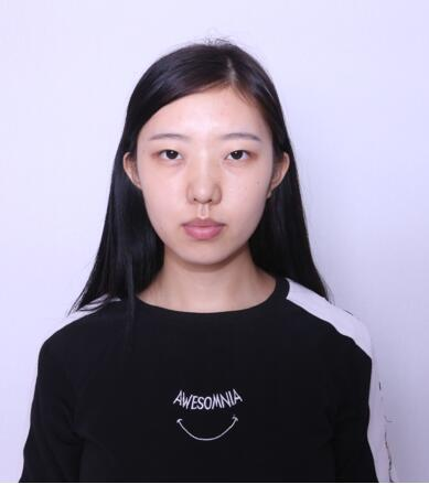 做雙眼皮案例，第四軍醫(yī)大學(xué)唐都醫(yī)院李望舟雙眼皮案例圖片