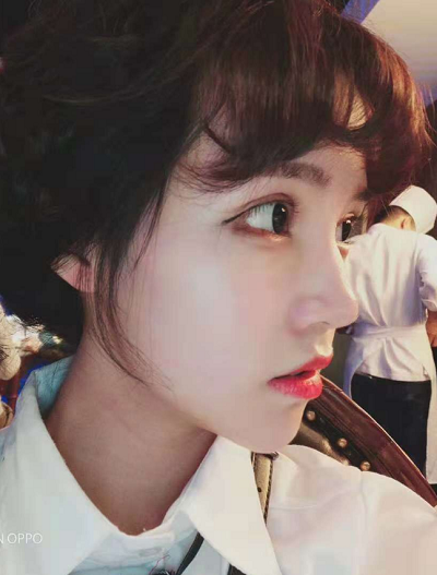 成都美立方（原華博）醫(yī)療美容醫(yī)院做眼部修復(fù)手術(shù)后的日?；謴?fù)