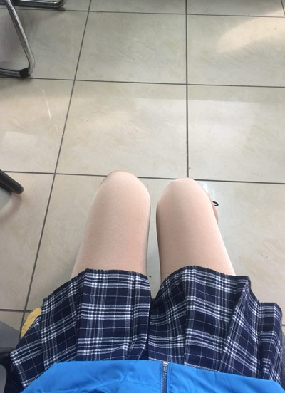 蘇州圣愛醫(yī)院醫(yī)療美容科做大腿吸脂手術(shù)后的恢復(fù)情況