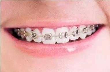 常州瀚景口腔牙齒拋光怎么樣？牙齒拋光有什么作用？